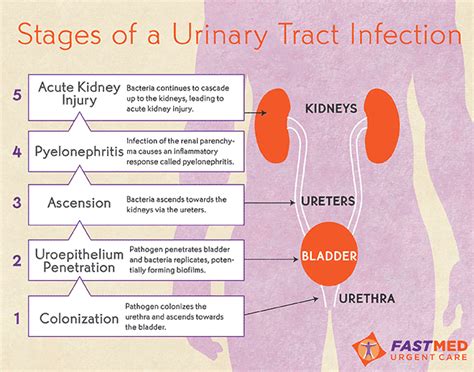  Bladder Infections: Recognizing the Symptoms and Treating Red Urine 