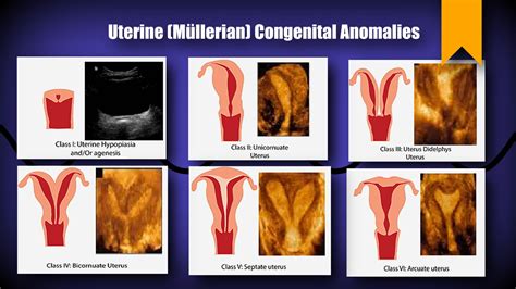 A Closer Look at Triple Nipples: Genetic Anomaly or Mere Variation?