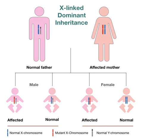 A Peek into Genetics: Decoding the Inheritance Patterns of Polydactyly