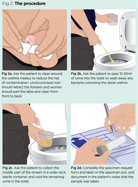 A Unique Scenario Unraveled: Understanding the Significance of Urinating in a Container