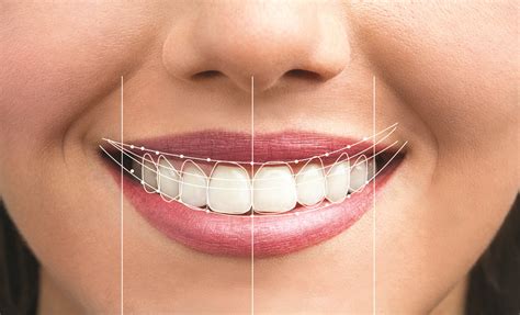 Achieving Your Desired Smile: Creating a Customized Treatment Plan