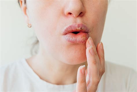 All You Need to Know About Puffy Lips: The Fundamentals