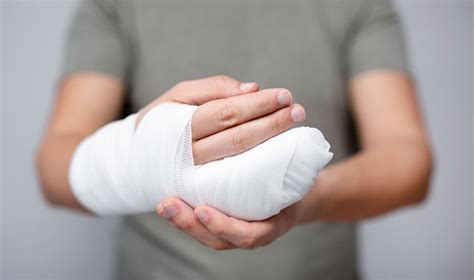 An Overview of Common Dreams Involving Hand Injuries