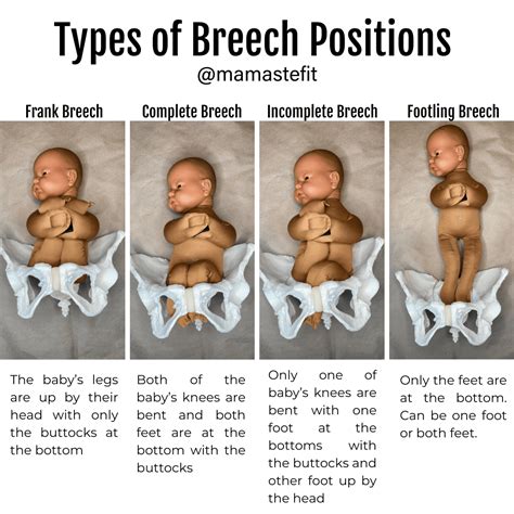 Analyzing the Emotional Impact of Dreaming about Assisting a Breeched Infant's Birth