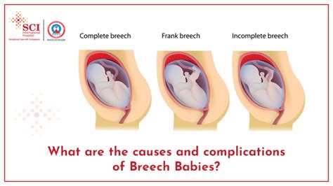 Analyzing the Possible Reasons for Dreaming of a Breech Baby