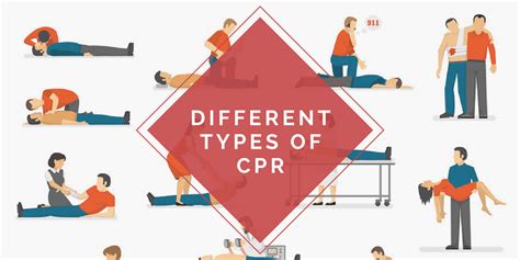 Analyzing the Various Aspects in CPR Dreams