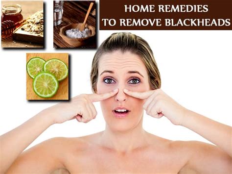 Banishing Blackheads: Effective Home Remedies