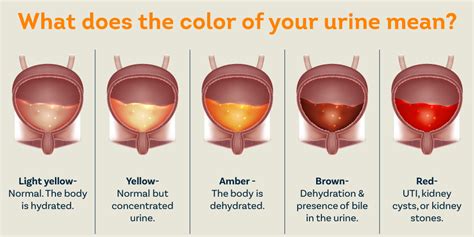 Blood in Urine: Understanding the Common Cause of Red Urine