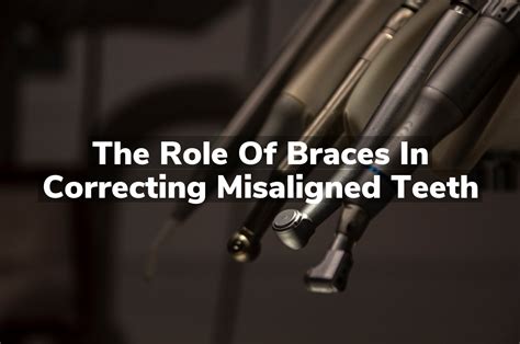 Braces: An Effective Solution for Correcting Significant Dental Misalignment