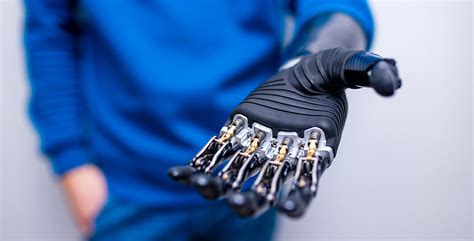 Bridging the Gap: Advancements in Prosthetic Limb Technology