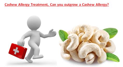 Cashew Allergies and Precautions to Take