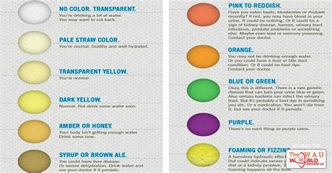 Causes of Abnormal Urine Color