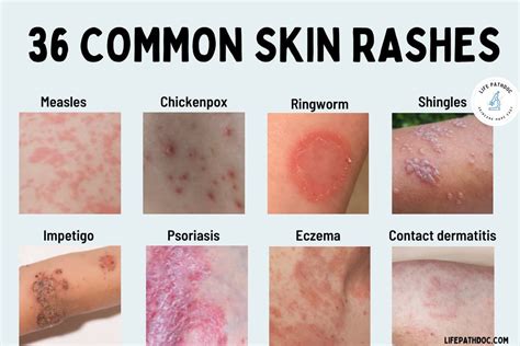 Causes of a Skin Irritation