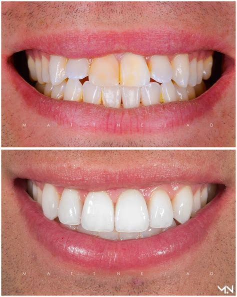 Choosing the Perfect Cosmetic Dentist for Your Smile Transformation