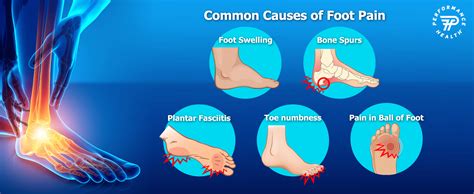 Common Causes of Foot Discomfort in Dreams and Reality