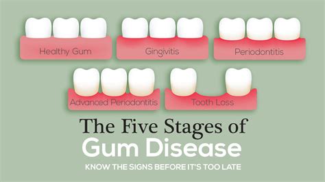 Common Causes of Gum Becoming Lodged