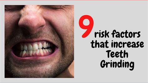 Common Causes of Teeth Grinding