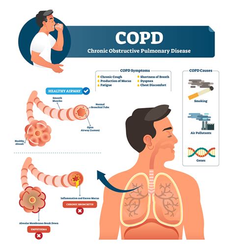 Common Indicators of Breathlessness: Noteworthy Signs and Symptoms