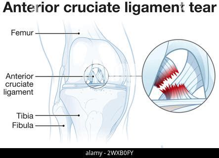 Common Issues Affecting the Knee that May Require Surgical Intervention