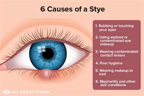 Common Triggers of Eye Debris Formation