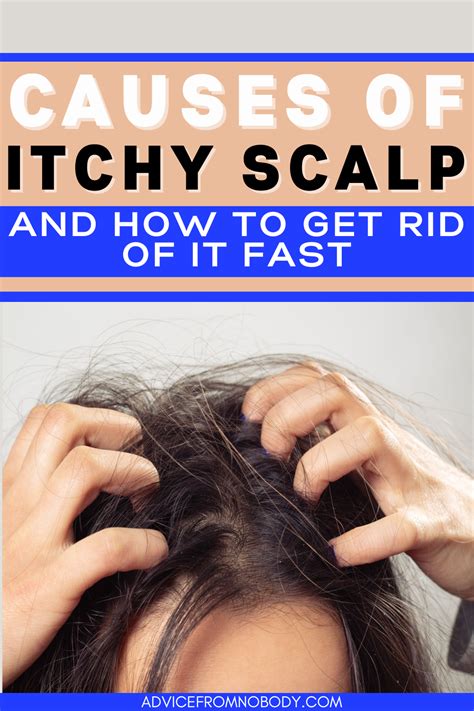 Common misconceptions about flaky scalp