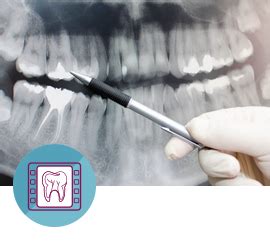 Communication Issues: Interpreting Extended Dental Structures as a Reflection of Challenges in Expressing Feelings