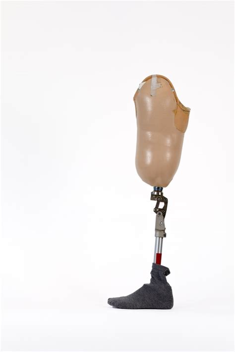 Comparing Wooden Legs and Modern Prosthetics: Advantages and Disadvantages