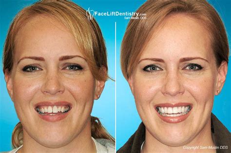 Comparing the Benefits of Big Teeth and Alternative Dental Procedures: Making the Right Choice for Your Smile