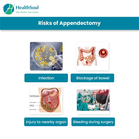 Complications and Long-term Effects of Appendicitis: When the Organ Malfunctions