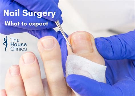 Considerations for Ingrown Toenail Surgery: Is it the Right Solution?