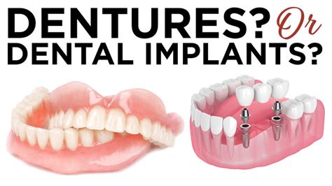 Considering the Advantages and Disadvantages of Artificial Dentures: What to Take into Account