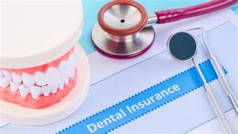 Considering the Financial Aspects: Exploring the Costs and Factors to Consider for Braces Removal