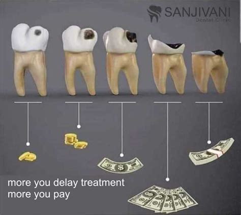 Costly Dental Procedures: A Result of Neglect