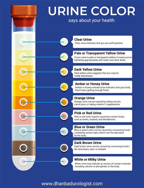 Dark Urine: A Sign of Certain Medications