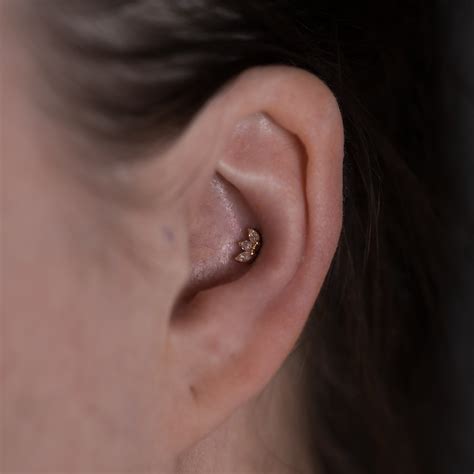 Dealing with Common Issues in Ear Piercing