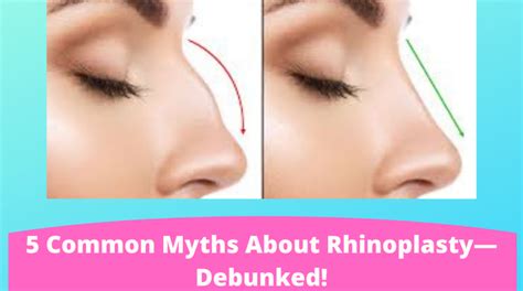 Debunking Common Concerns and Myths Surrounding Rhinoplasty