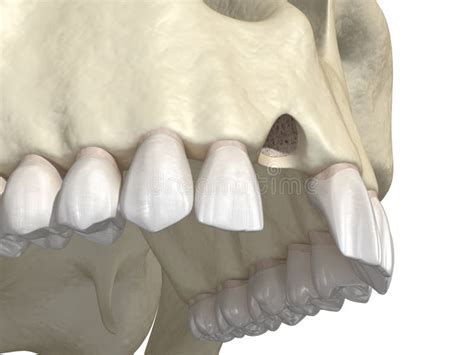 Deciphering the Potential Significance of an Unsteady Incisor in One's Dreams