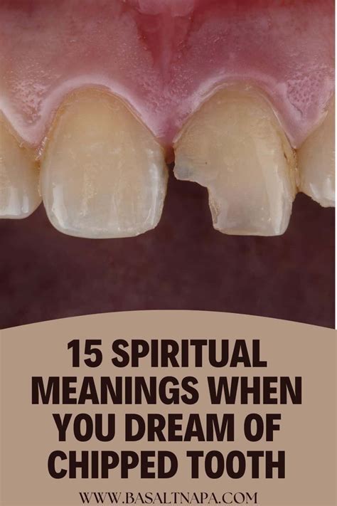 Decoding Tooth Dreams: Unraveling Their Hidden Meaning