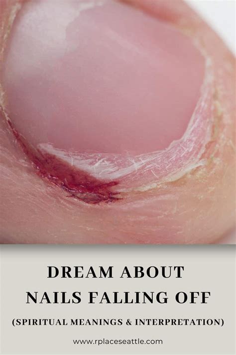 Decoding the Message: Interpreting Dreams of Damaged Artificial Nails