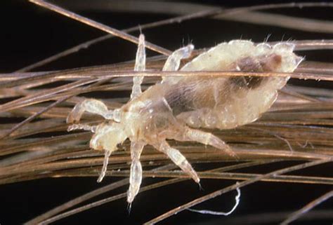 Decoding the Psychological Meaning of Head Lice Eggs in Dreams