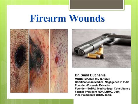 Decoding the Symbolism Behind a Wound Caused by a Firearm: Unveiling the Message