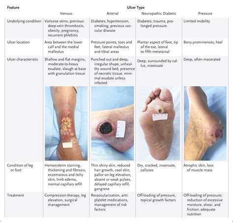 Deep-rooted Feelings: Unraveling the Psychological Significance of an Ulcer on the Lower Limb