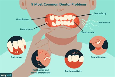 Dental Health Issues