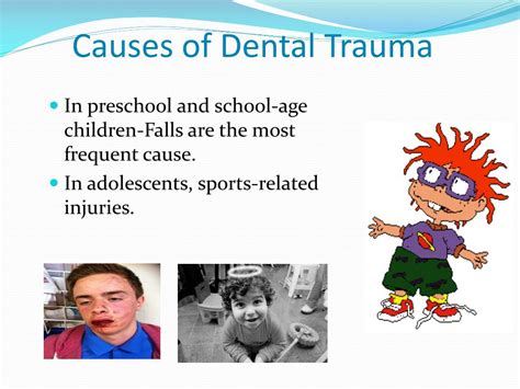 Dental Trauma: Understanding the Physical Causes