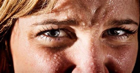 Determining the Underlying Factors of Excessive Facial Perspiration