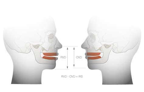 Discovering the True Vertical Dimension