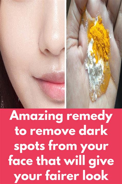 Ditch the Spots: Natural Remedies for a Radiant Visage