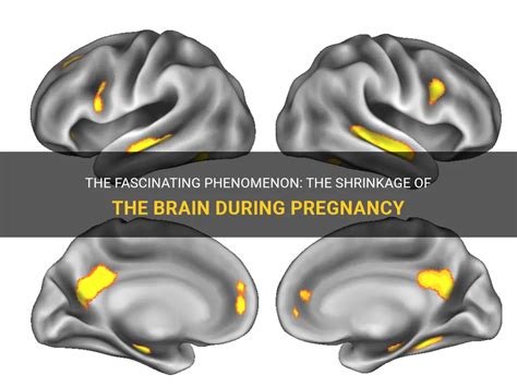 Diving into the Fascinating Phenomenon of Prenatal Bonding