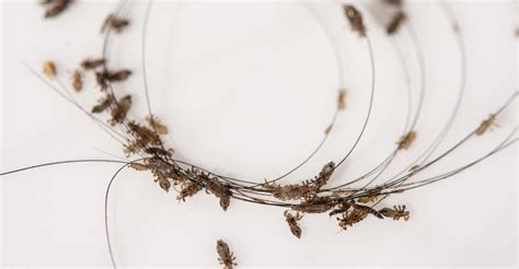 Dream Interpretation: Decoding the Symbolism of Head Lice in Your Dreams