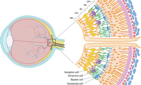 Dreaming of Faking Visual Impairment: Decoding the Symbolism